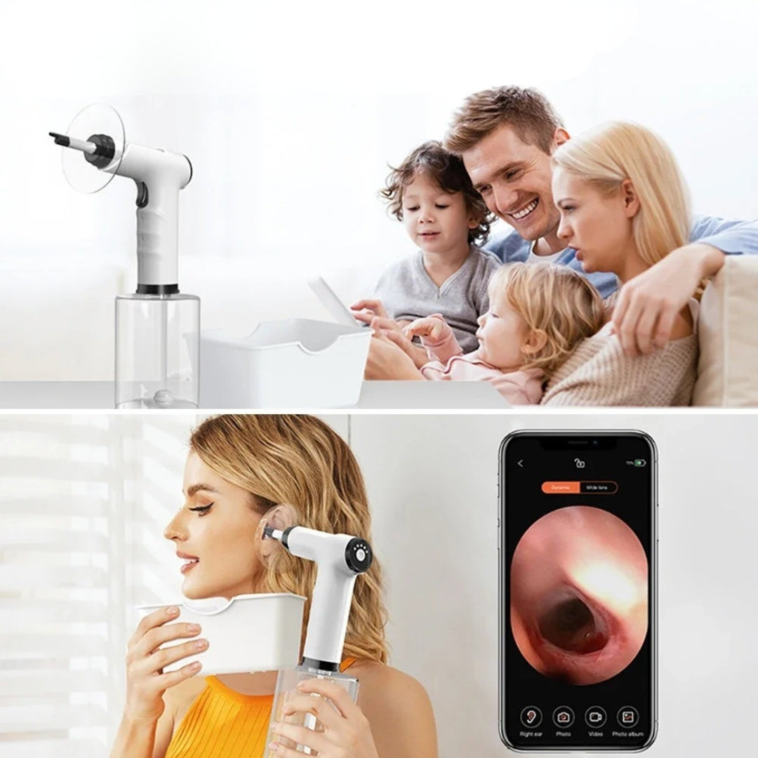 PopLobe™ - Ear Wax Remover
