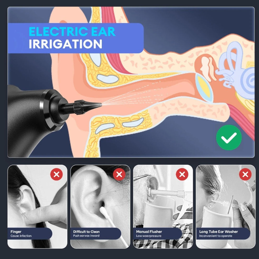 EarNobi™ - Ear Wax Pro