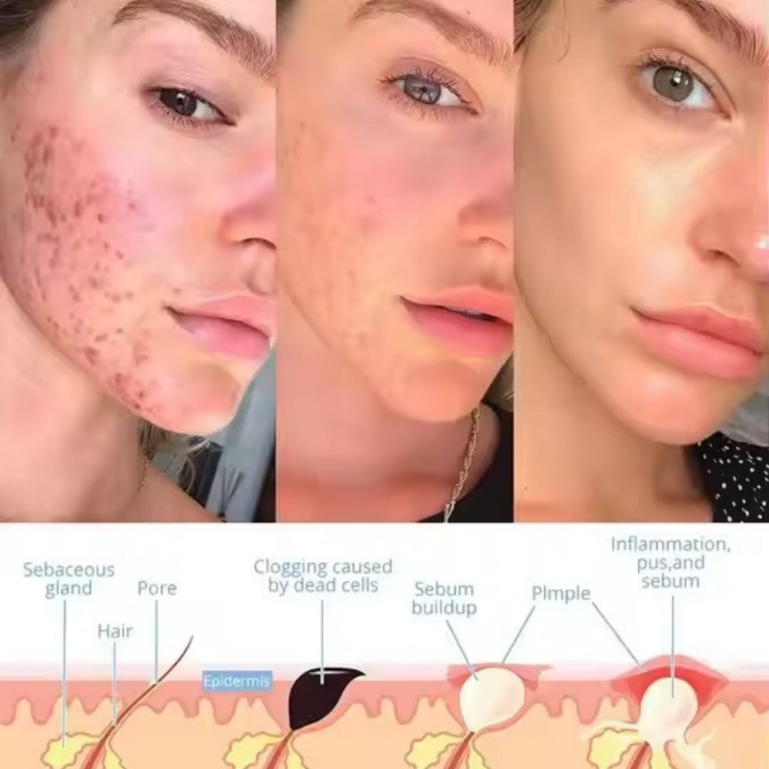 TheraNique™ - Facial Wand
