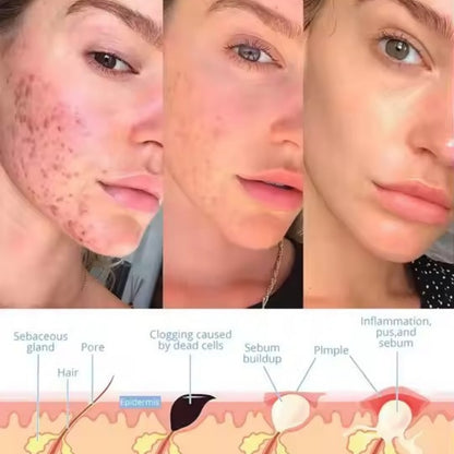 TheraNique™ - Facial Wand